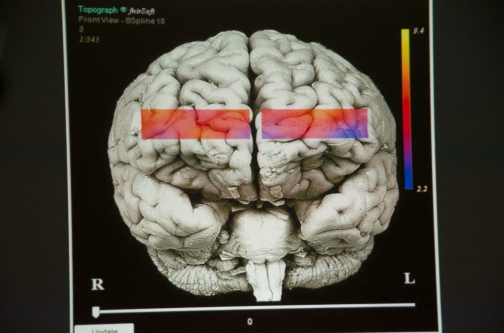 One of the result graphics projects onto a generic image of the brain demonstrating in reds and blues the oxygenation levels of the test subject.